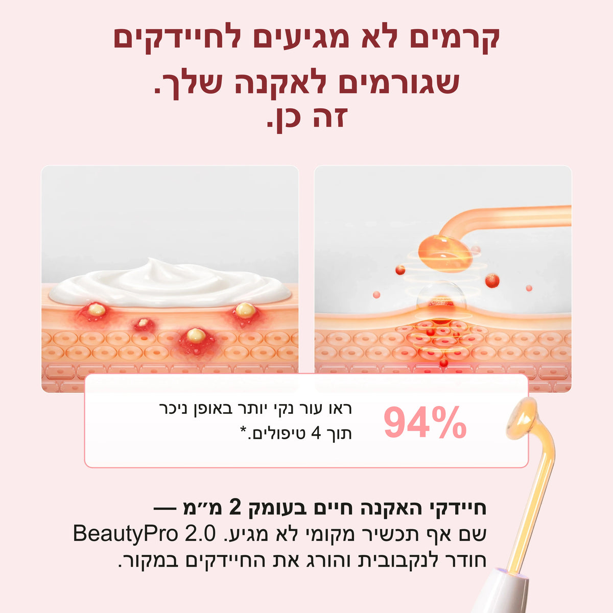 גלריה 2