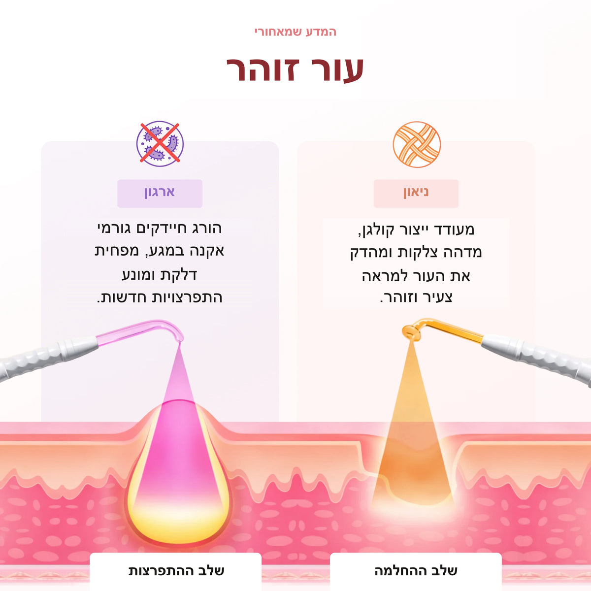 גלריה 4